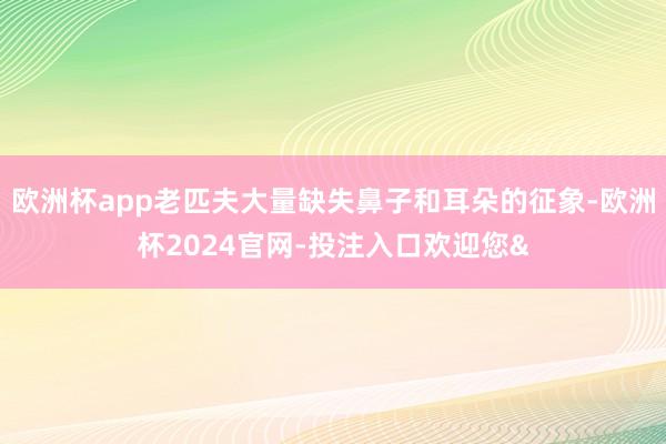 欧洲杯app老匹夫大量缺失鼻子和耳朵的征象-欧洲杯2024官网-投注入口欢迎您&